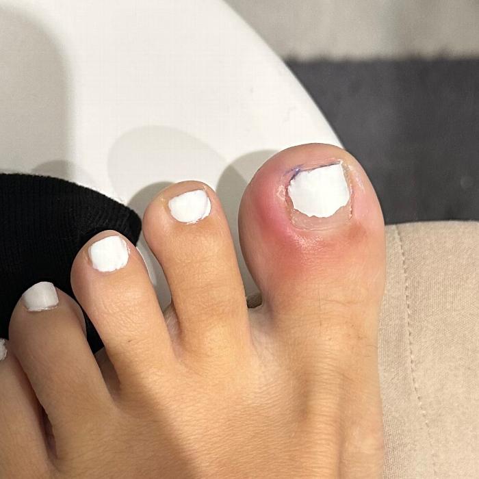 Podiatrist  in Send